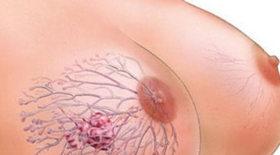 Боль в грудной клетке посередине. Каковы могут быть причины дискомфорта в груди? Болевые ощущения в груди у женщины