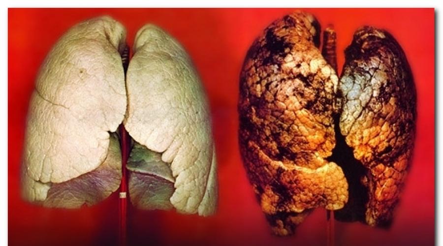 Рак и курение. Рак губы от курения не в затяг Зависимость онкологических заболеваний от курения матери шй