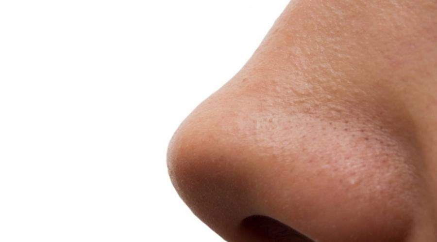 Утолщение носовой перегородки. Какие могут быть последствия искривления носовой перегородки