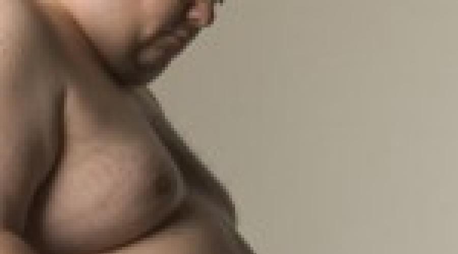 Виды ожирения у мужчин и способы его лечения. Особенности ожирения мужчин по женскому типу