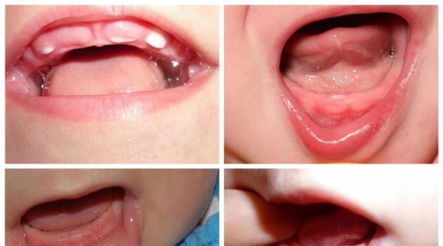 Сколько зубов меняется у ребенка. Особенности замены молочных зубов на постоянные