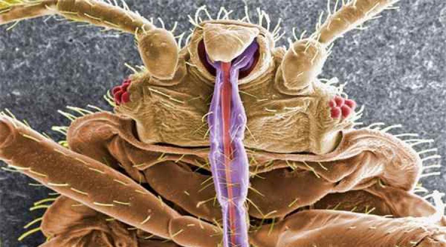 Самый жуткий червь с неожиданной уловкой. Самые ужасные, опасные и страшные паразиты человека Обычная ванделлия – рыбка-вампир