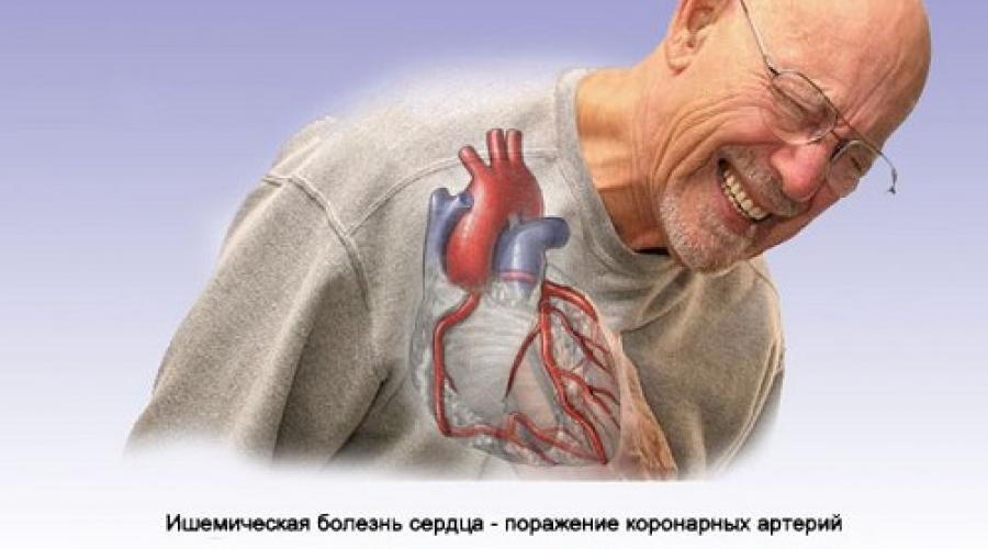 Лечение сердца коронарное. Лечение ИБС: как остановить болезнь и спасти жизнь от инфаркта