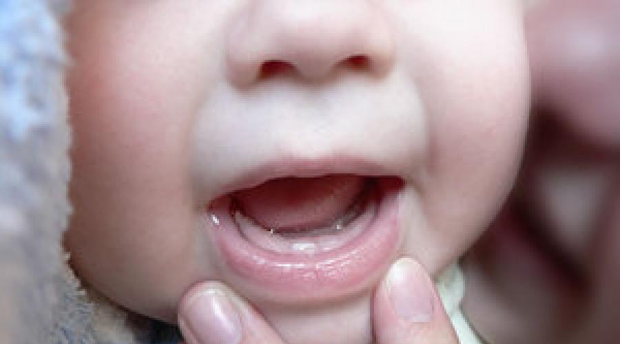 Во сколько лезет первый зуб. Во сколько месяцев режутся зубки у мальчиков? Вот частые вопросы, которые задают встревоженные мамы