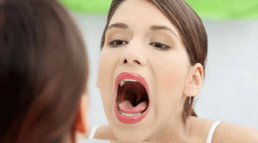 Причины плохого запаха изо рта. Гнилостный запах изо рта: причины и диагностика