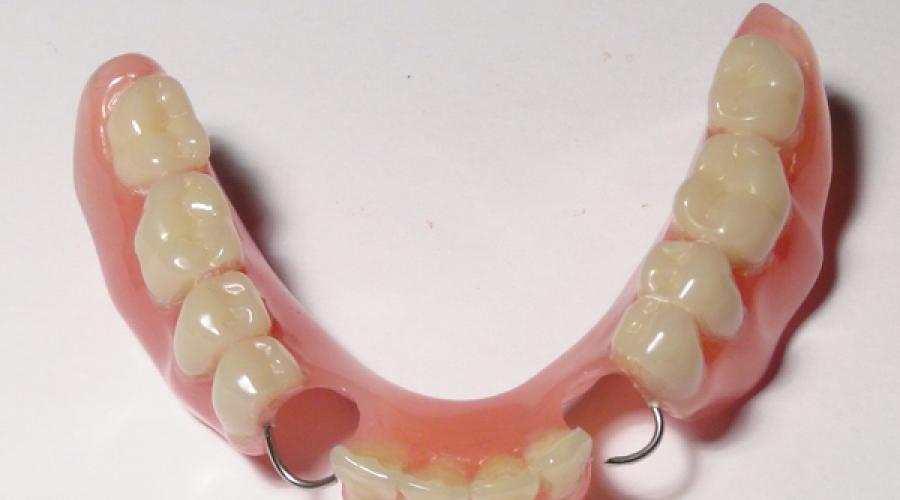 Съемные протезы передних зубов. Съемные зубные протезы: виды, особенности, отзывы, цены