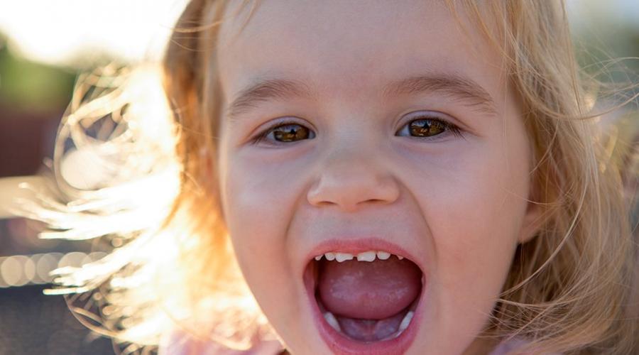 Желтые зубы у ребенка: возможные причины и профилактика пегментации. Жёлтые зубы у ребенка