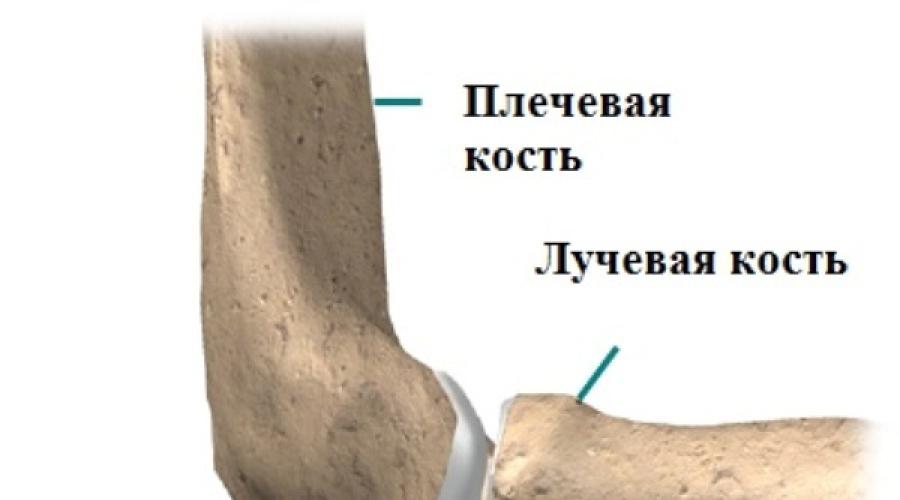 Вывих локтевого сустава и его лечение. Способы лечения вывиха локтевого сустава Армянский тяжелоатлет карапетян вывернул локоть на олимпиаде