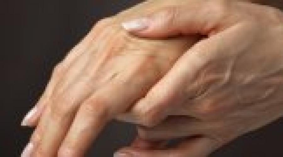 Причины отечности рук у женщин. Причины и лечение отека рук