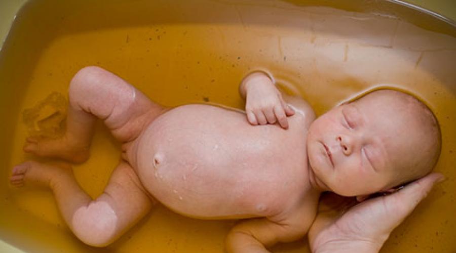 Череда для купания новорожденных. Лечебные и полезные свойства череды для организма и противопоказания