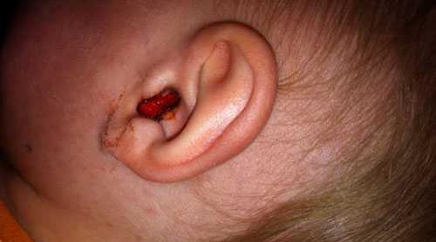 Почему маленький ребенок чешет ухо. Почему уши чешутся внутри: диагностика и причины