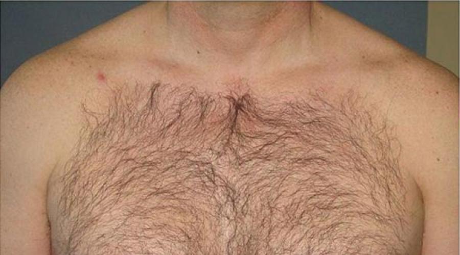 Почему у мужчин на груди растут волосы. Украшает ли мужчину повышенный волосяной покров