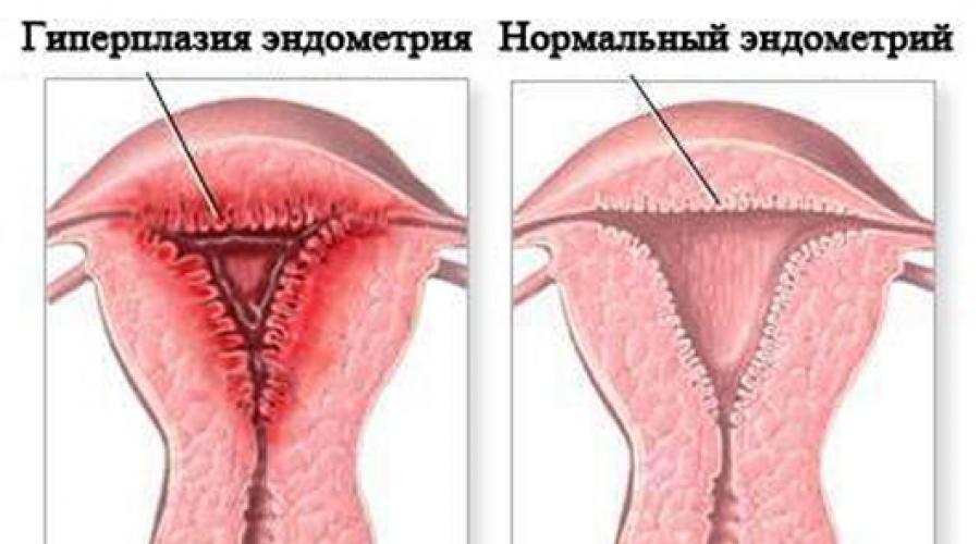 Какое значение имеет эндометрий матки в гинекологии. Нормальная толщина функционального слоя в разные дни цикла