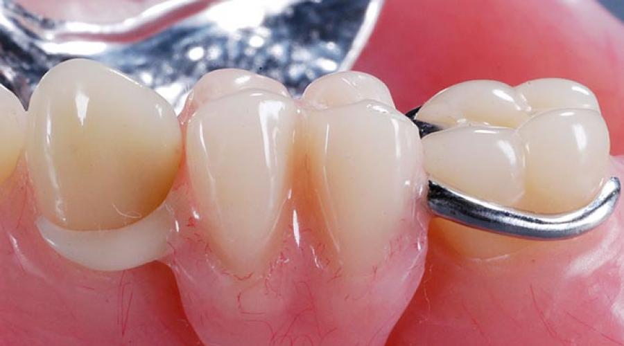 Новое в ортопедии стоматологии. Передовые технологии в современной стоматологии