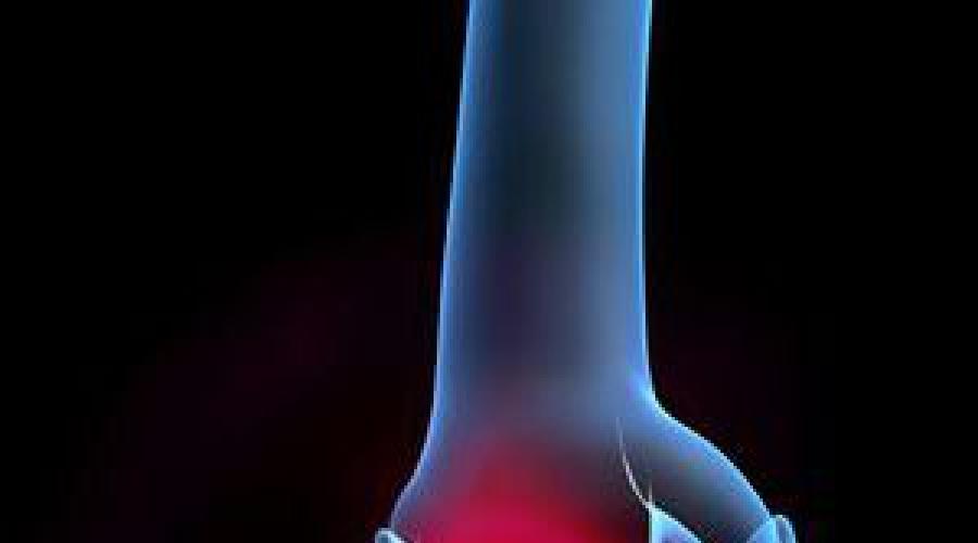 Как избавиться от боли в колене с внутренней стороны? Боль в колене с внешней стороны сбоку — причины, методы лечения Воспалилось колено с наружной стороны. 