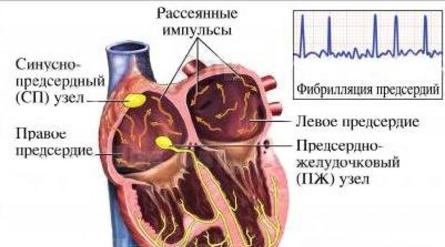 Причины резкого повышения сердцебиения. Таблетки от тахикардии и сердцебиения