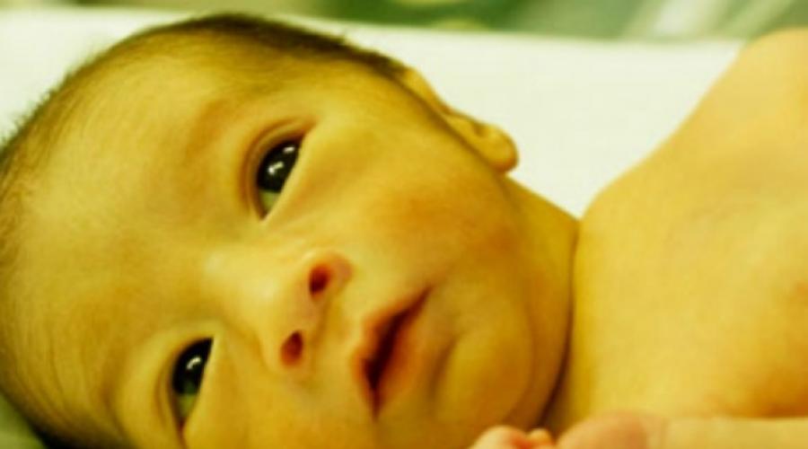 Виды желтухи у новорожденных. Физиологическая желтушка новорожденных