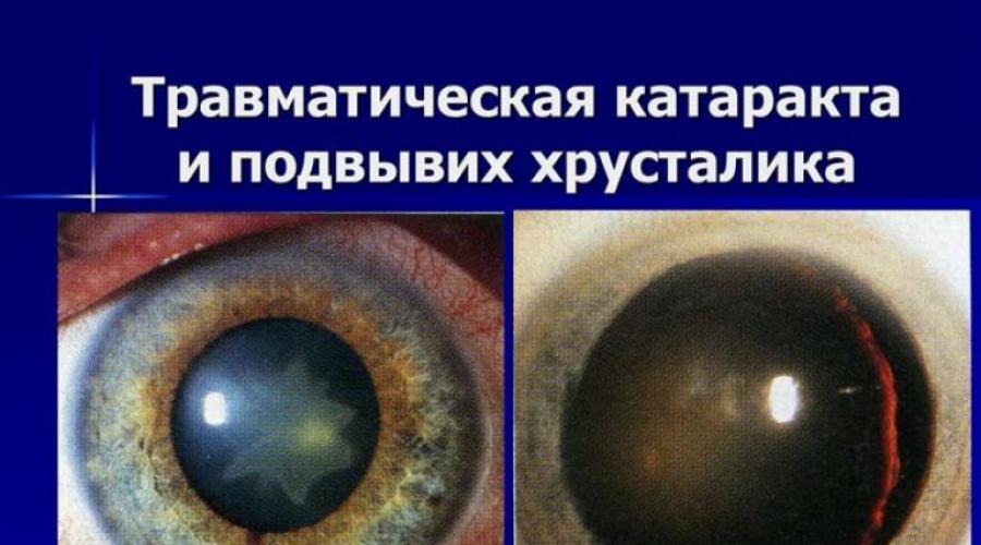 Контузия хрусталика глаза после хирургического вмешательства. Травматические повреждения радужки и хрусталика