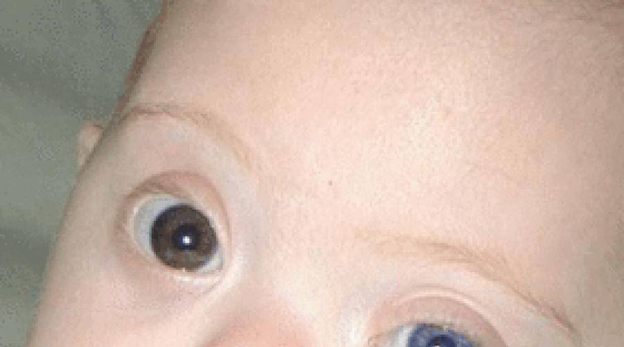 Когда рождаются дети с карими глазами. Изменение цвета глаз у новорожденных