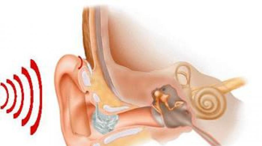 Как правильно выбрать слуховой аппарат? Классификация слуховых аппаратов Слуховые аппараты виды и характеристики. 