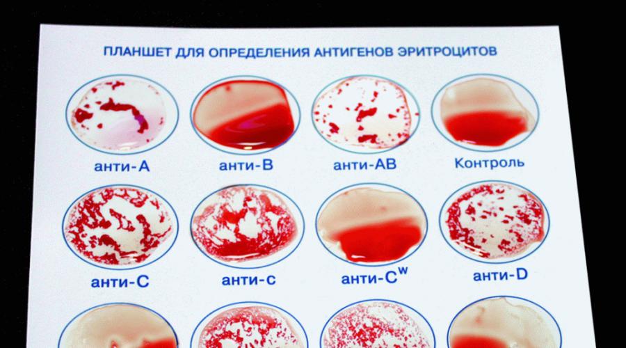 Тест на русскую кровь