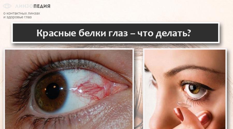 Красные глаза как у. Причины покраснения глаз и появления чувства усталости