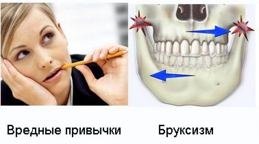 Крошатся зубы, что делать в такой ситуации? Почему разрушается зубная эмаль, что делать, если зубы начали крошиться. 