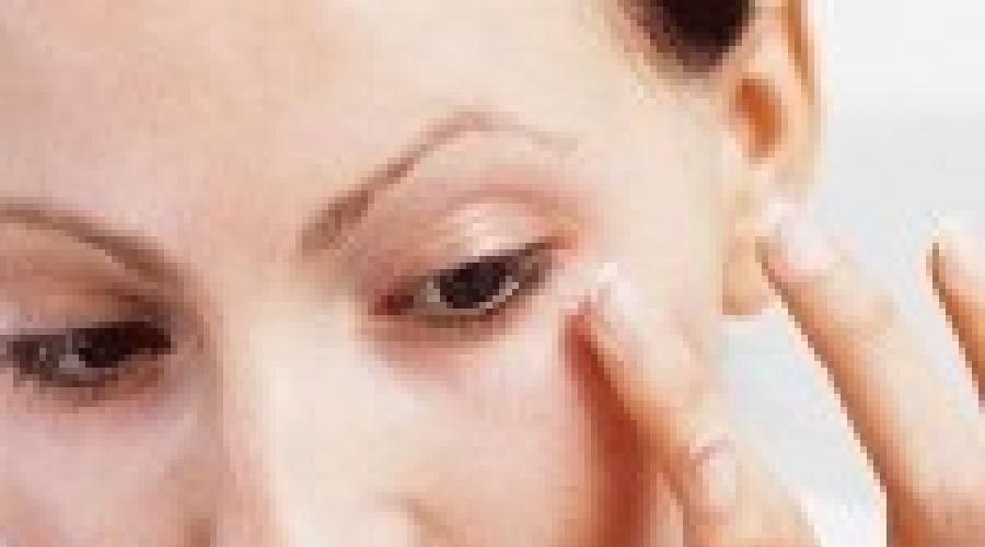 Ушиб глаза: симптомы и лечение. Методы быстрого избавления гематомы глаза после удара: лечение медикаментами и народными средствами