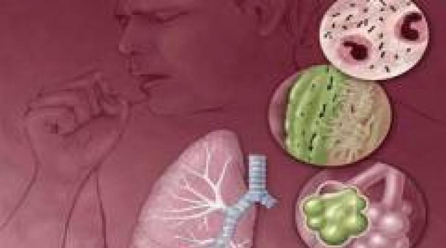 Есть ли польза от народных средств при лечение саркоидоза лёгких? Что такое саркоидоз легких: лечение и симптомы. 