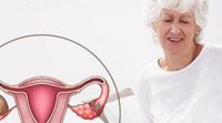 Кисты яичников у женщин после 50 лет. Появление кисты яичника после климакса