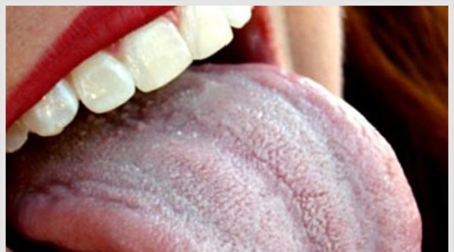 Белый налет на зубах: причины и как убрать. Как убрать налет с языка