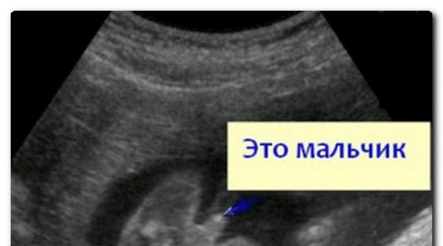 16 недель беременности можно узнать пол. УЗИ на 19 неделе беременности пол ребенка мальчик. УЗИ 19 недель беременности мальчик. Малыш на 16 неделе беременности УЗИ. УЗИ 16 недель беременности мальчик.