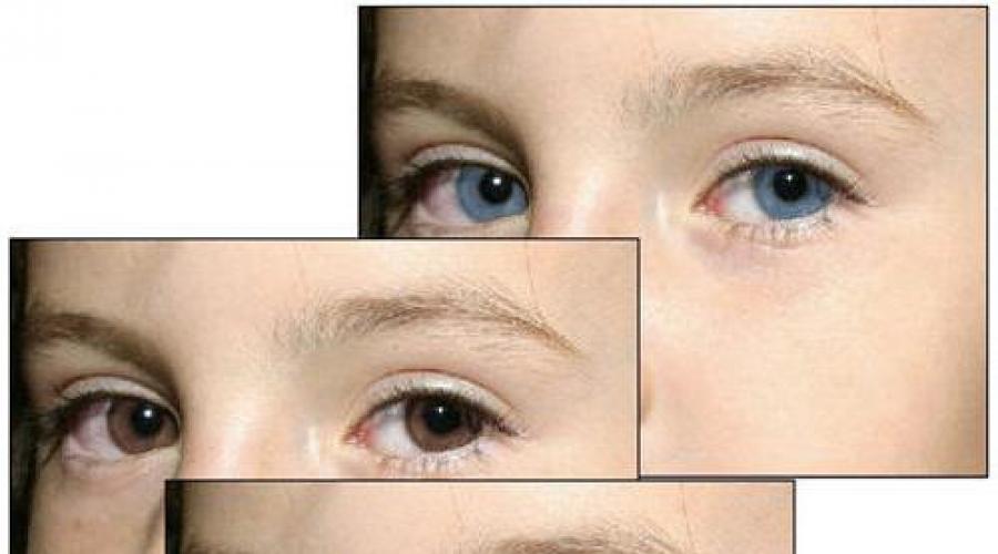 Почему глаза меняют цвет? Почему меняется цвет глаз у взрослого человека: что на это влияет. 
