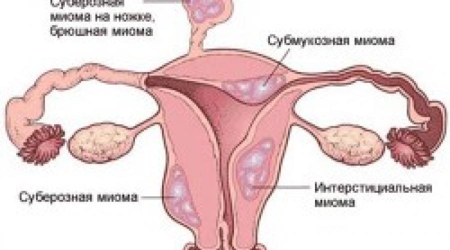 Женская онкология. Основные признаки онкологии по-женски