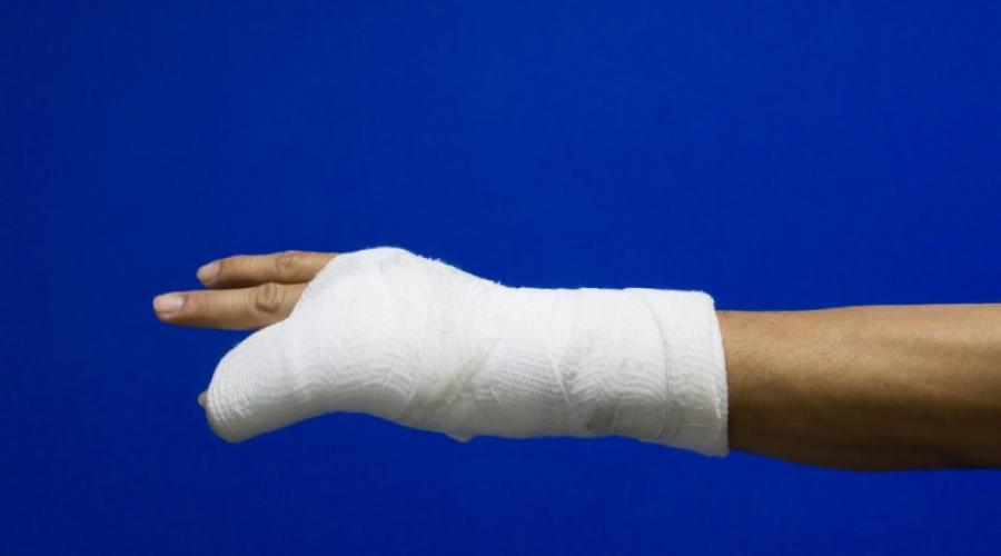  Признаки перелома пальца на руке, лечение. 
