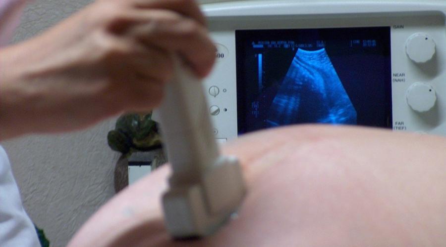 Как самостоятельно снять тонус матки во время беременности? Что такое тонус. Тонус при беременности: симптомы и особенности