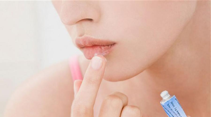 Чем помазать заеды в уголках губ. Как лечить заеды в уголках губ: эффективные методы и препараты