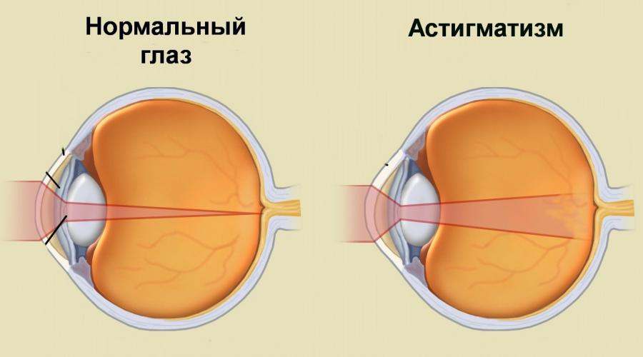 Гимнастика для глаз для улучшения зрения: упражнения с видео. Самые эффективные упражнения для глаз при дальнозоркости, предназначенные для улучшения зрения