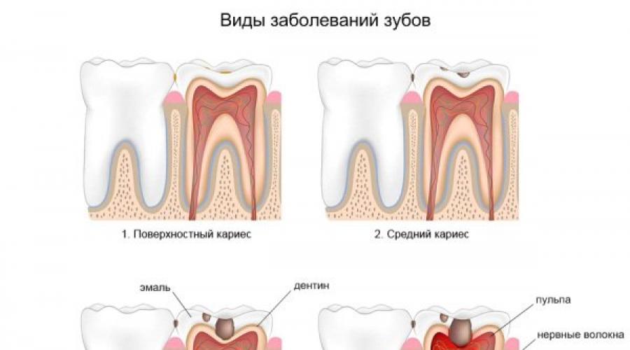 Можно ли лечить зубы на ранних сроках