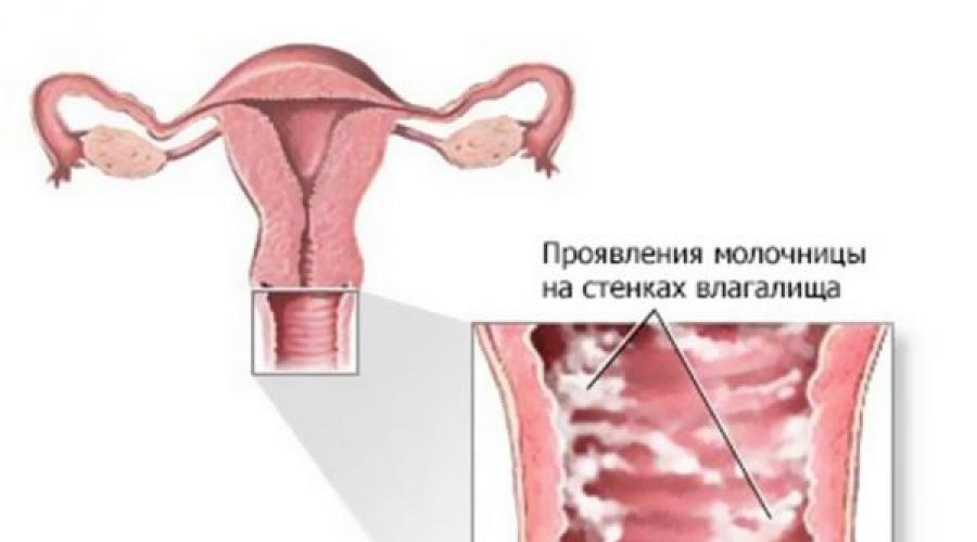 Чешутся половые губы зудят при беременности. Во время беременности появился зуд и покраснение половых губ