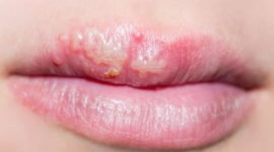 Белые точки на губах под кожей: фото, причины, удаление. Причины и лечение белых пятен на губах