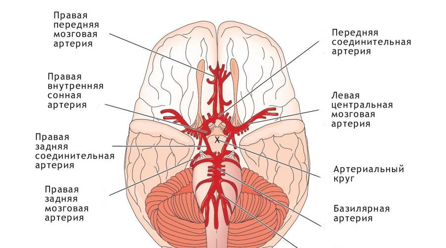 Сужение сосудов в позвоночном канале или гипоплазия левой позвоночной артерии: причины развития и способы лечения. Гипоплазия правой позвоночной артерии