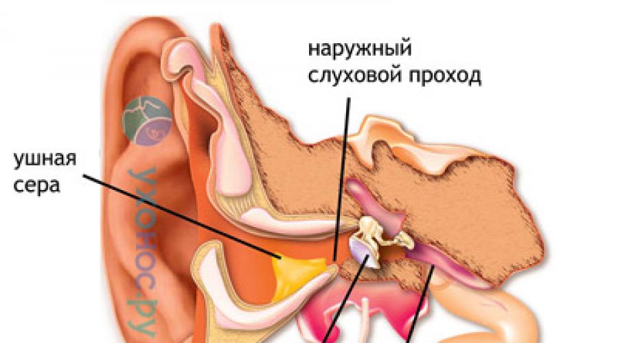 Ушная сера: функции, норма и патология, изменения цвета, количества, констистенции. Почему у человека может быть много серы в ушах