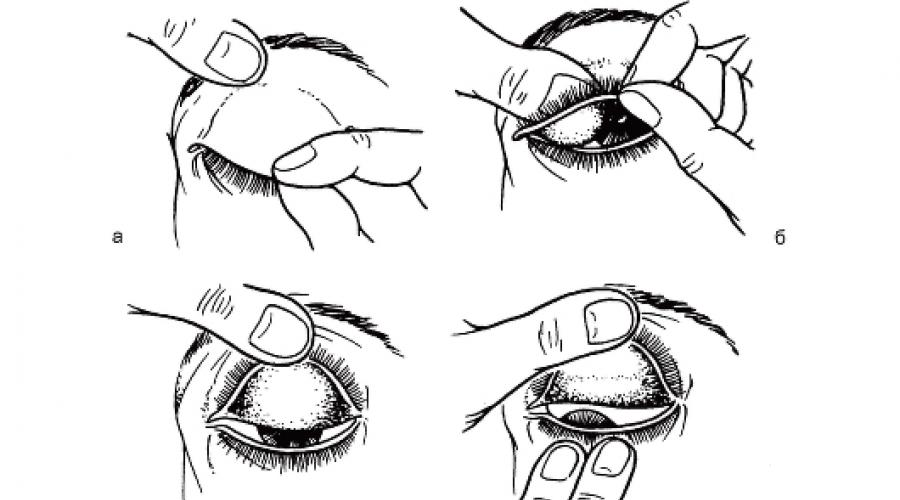На каком обследование видно связки глаза. Диагностика заболеваний глаз - методы исследования глаз в офтальмологии
