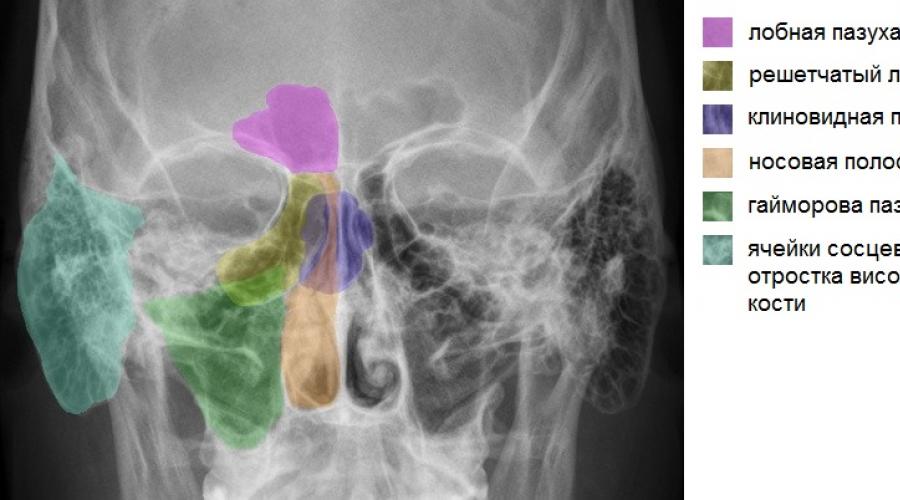 Снимок уха где можно сделать. Рентген височных костей по Шюллеру, Майеру и Стенверсу: что это, как проходит? Какие патологии выявляются