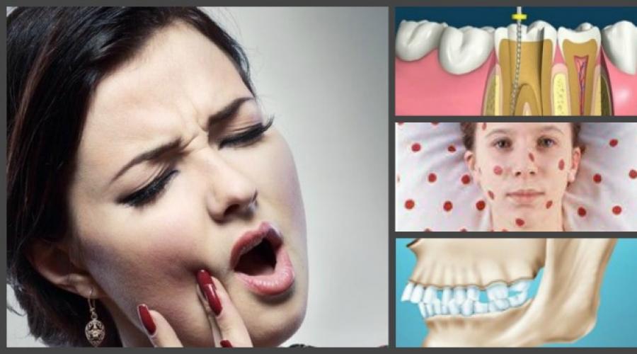  Почему болит зуб при надавливании и лечение. 