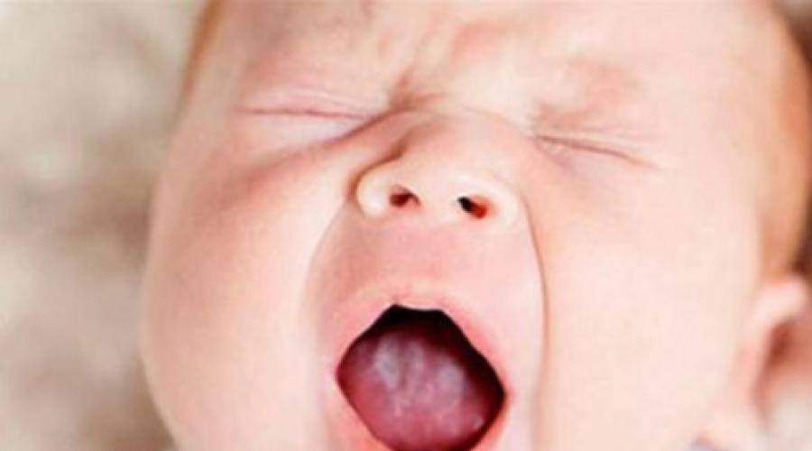 Неприятный запах изо рта у детей: причины. Почему изо рта у ребенка плохо пахнет? Аромат ацетона: причины, симптомы, лечение