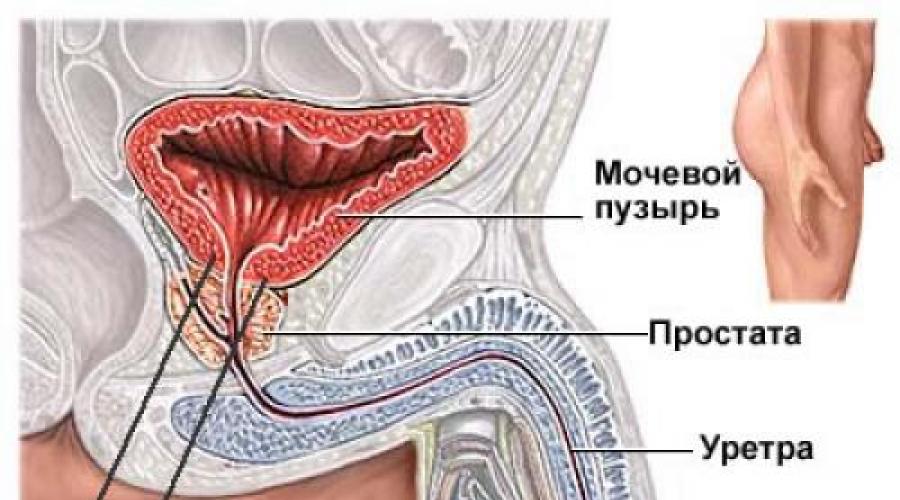Что такое уретра? Воспаление мочеиспускательного канала у женщин. 