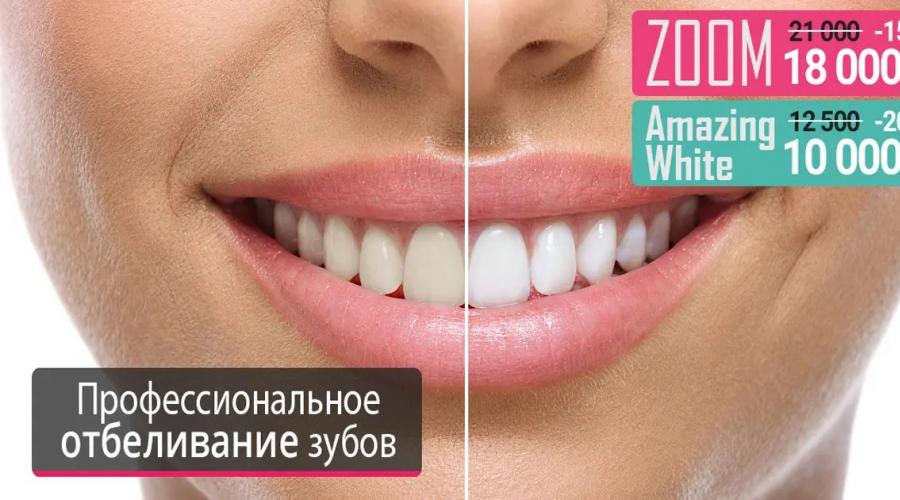 Отбеливание зубов. Отбеливание зубов: особенности процедуры, виды и цены Отбеливание зубов в стоматологии
