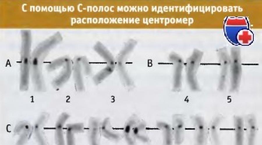 Центромера в хромосоме выполняет функции. Центромера: расположение и роль в сегрегации хромосом при митозе и мейозе